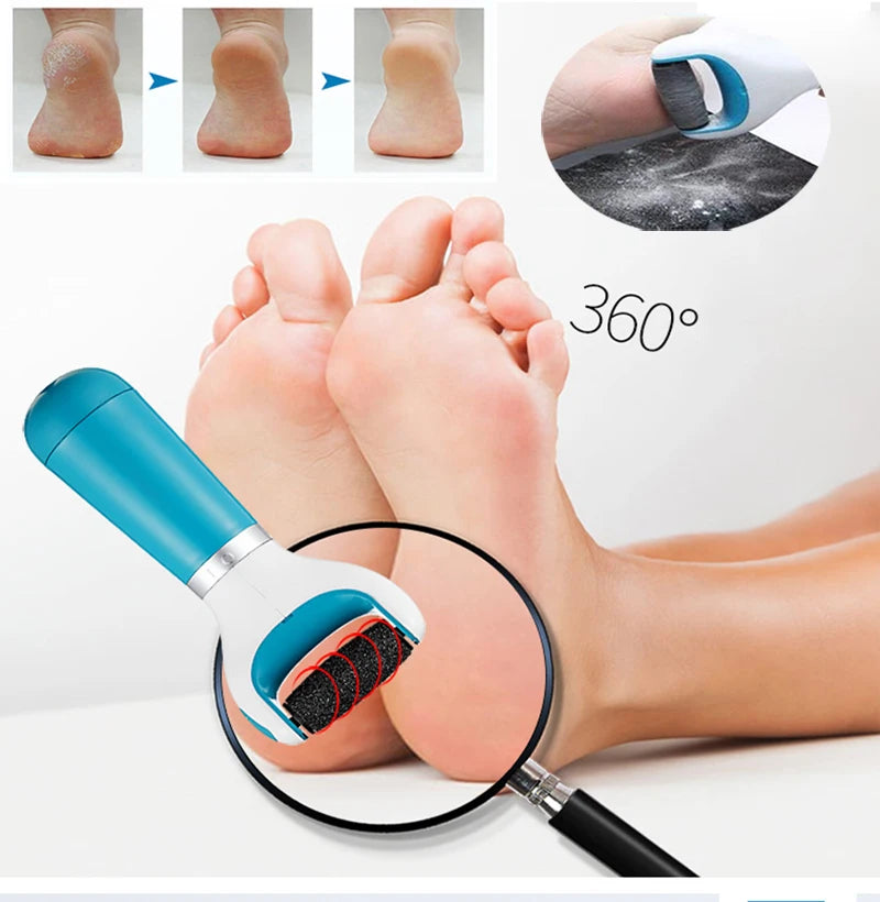 Electric Foot File Scraper Callus Remover Feet Professional Matte Pedicure Tools  Foot Corn Removal Dead Skin Remover Foot Care
