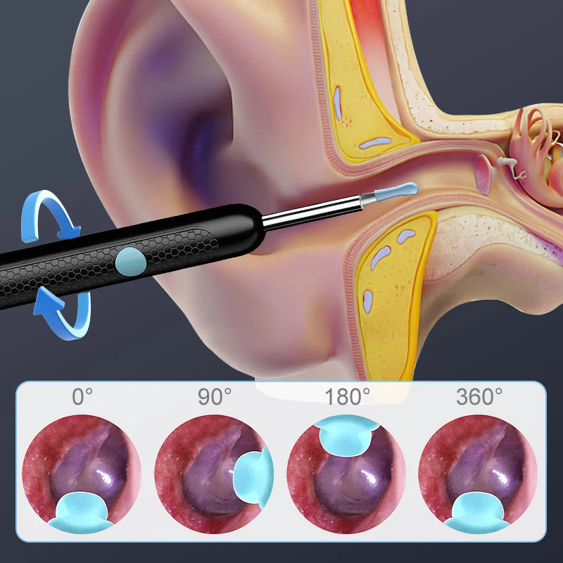 WIFI Visual Ear Camera Ear Pick Digital Ear Spoon Wireless Ear Cleaning Endoscope Ear Wax Removal Tool For Iphone Android Phones