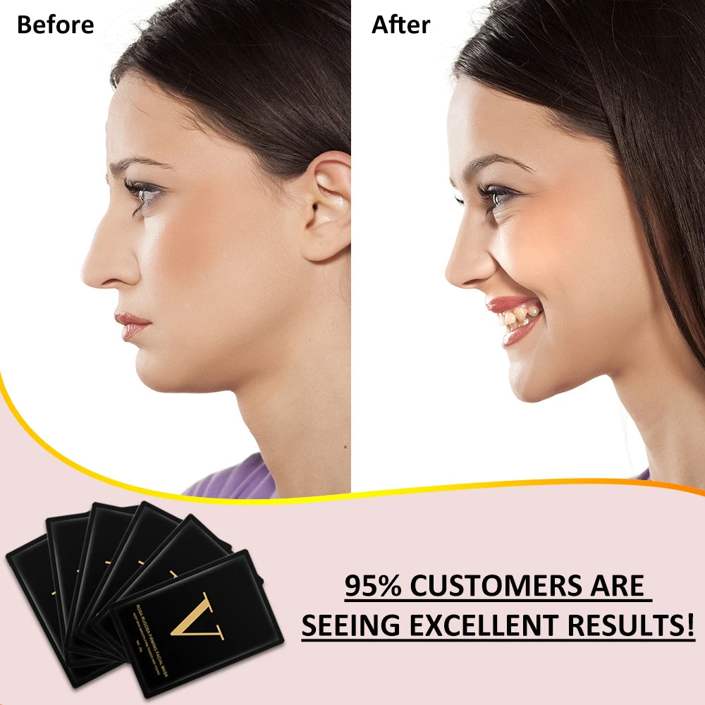 4D V shape Lifting Face Mask Ear Hanging Chin Cheek Lift Facial Slimming Hydrogel Thin Face-Lifting Slimmer Mask Black Packaging