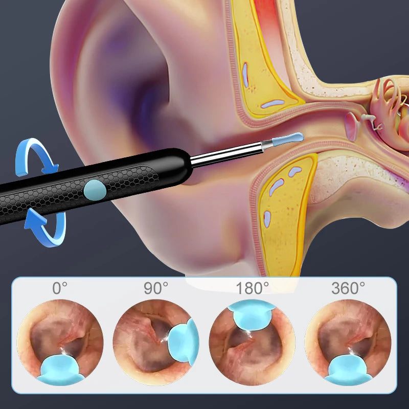 WIFI Visual Ear Camera Ear Pick Digital Ear Spoon Wireless Ear Cleaning Endoscope Ear Wax Removal Tool For Iphone Android Phones