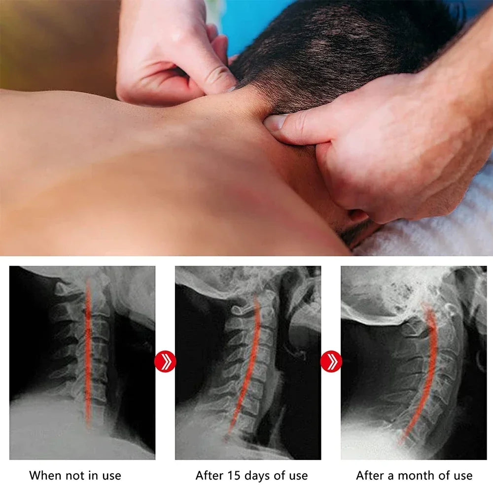 Cervical Traction Device Neck Massager for Cervical vertebra Shoulder Stretcher Trigger Point Massager Neck Acupressure Device