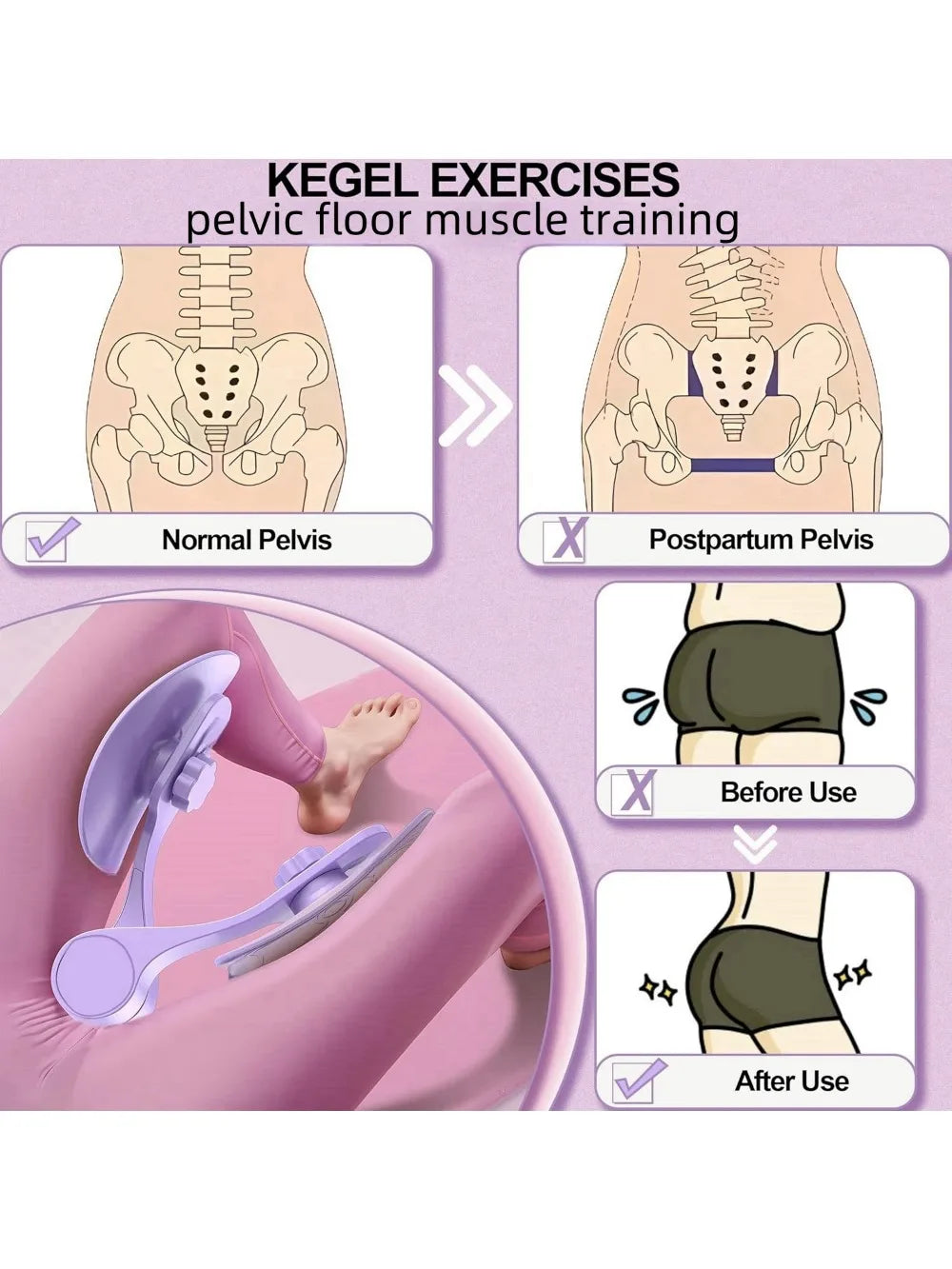 Kegel Pelvic Floor Muscle Trainer - Pink, Fit for Thigh Muscle Training, Home Gym Fitness Equipment for Women