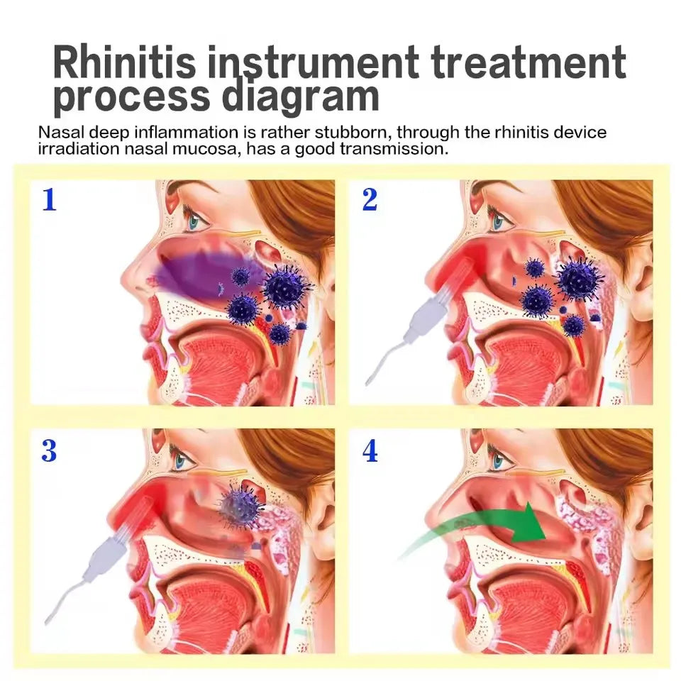 Nose Rhinitis Sinusitis Cure BioNase Laser Therapy Hay Fever Low Frequency Pulse Nose Massage Runny Sneeze Treatment Machine