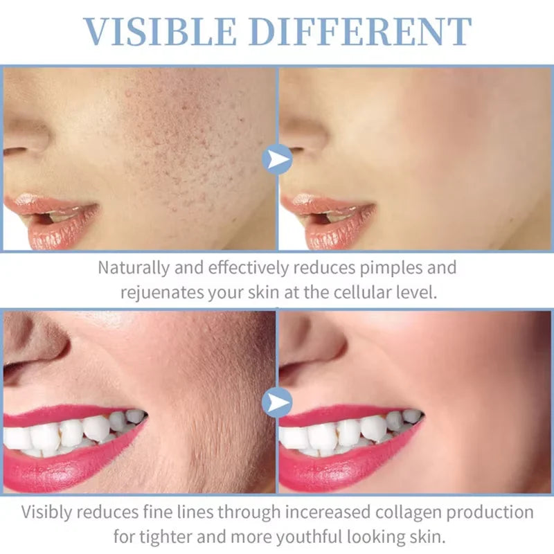 4 in 1 Electrode Glass Tube Machine High Frequency Skin Spot Acne Wand Facial Spa Face Skin Care Electrotherapy