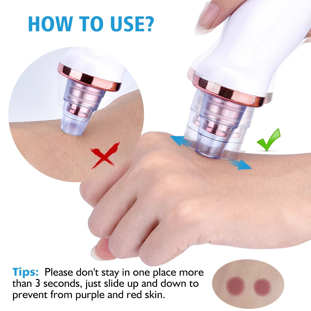Facial Blackhead Remover Electric Acne Cleaner Blackhead Black Point Vacuum Cleaner Tool Black Spots Pore Cleaner Machine