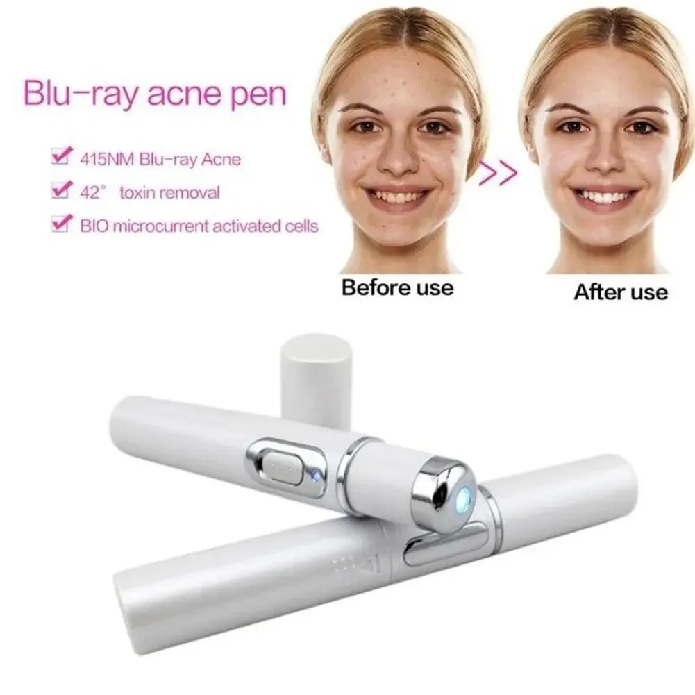 Blue Light Therapy Acne Laser Pen,LED Face Light Therapy For Scar Wrinkle Removal Treatment Device,Skin Care Beauty Appliances