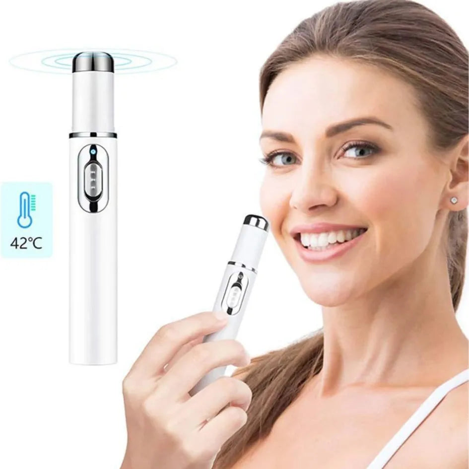 Blue Light Therapy Acne Laser Pen,LED Face Light Therapy For Scar Wrinkle Removal Treatment Device,Skin Care Beauty Appliances
