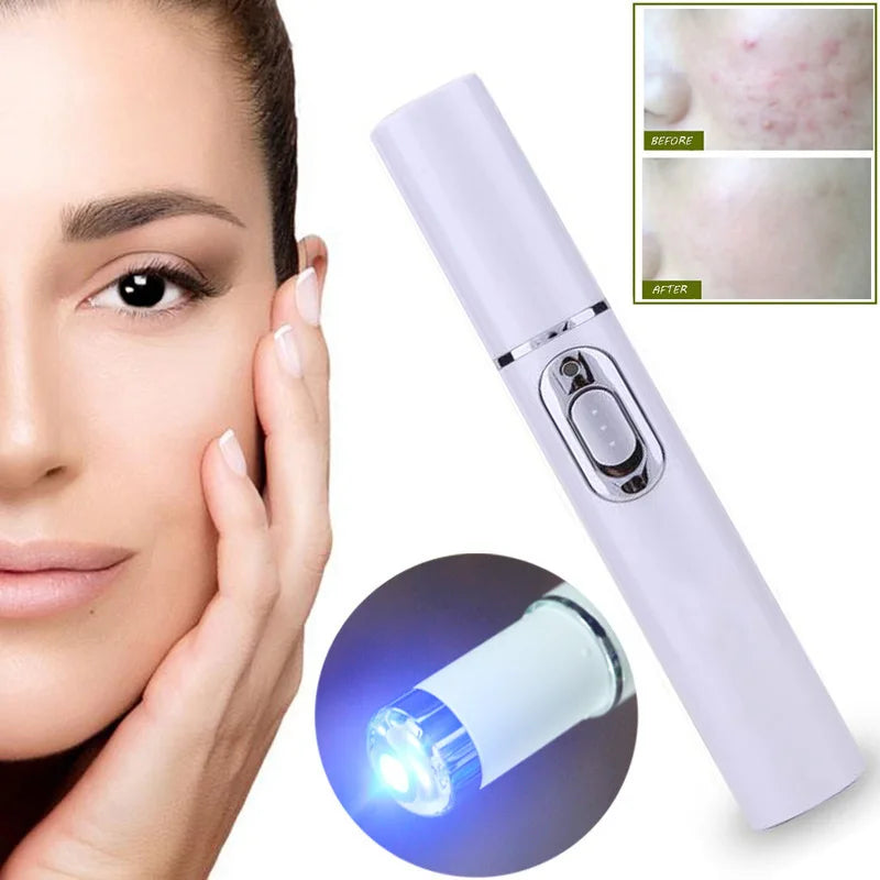 Blue Light Therapy Acne Laser Pen,LED Face Light Therapy For Scar Wrinkle Removal Treatment Device,Skin Care Beauty Appliances