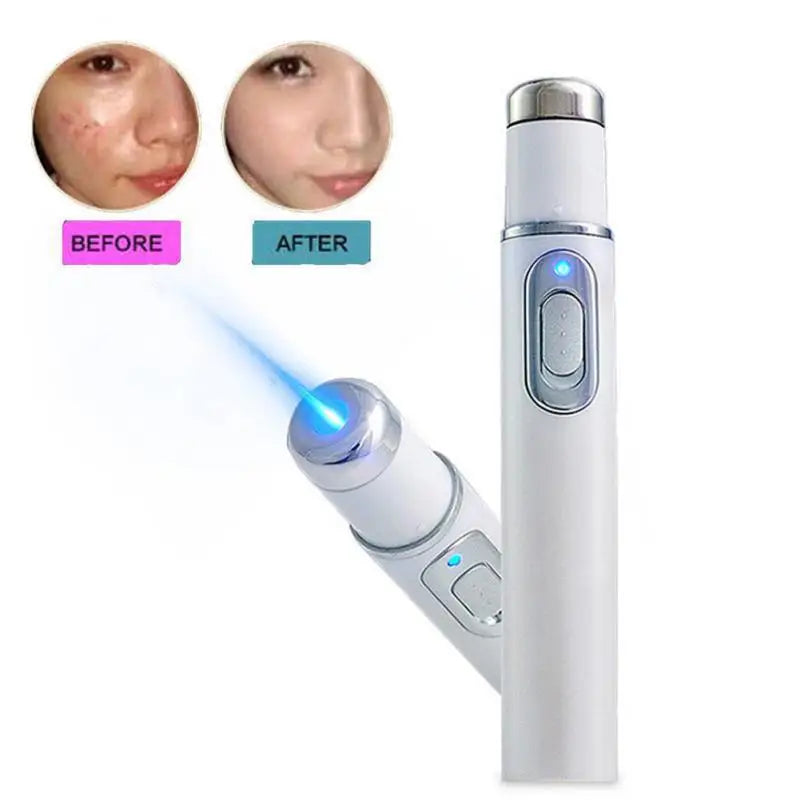 Blue Light Therapy Acne Laser Pen,LED Face Light Therapy For Scar Wrinkle Removal Treatment Device,Skin Care Beauty Appliances